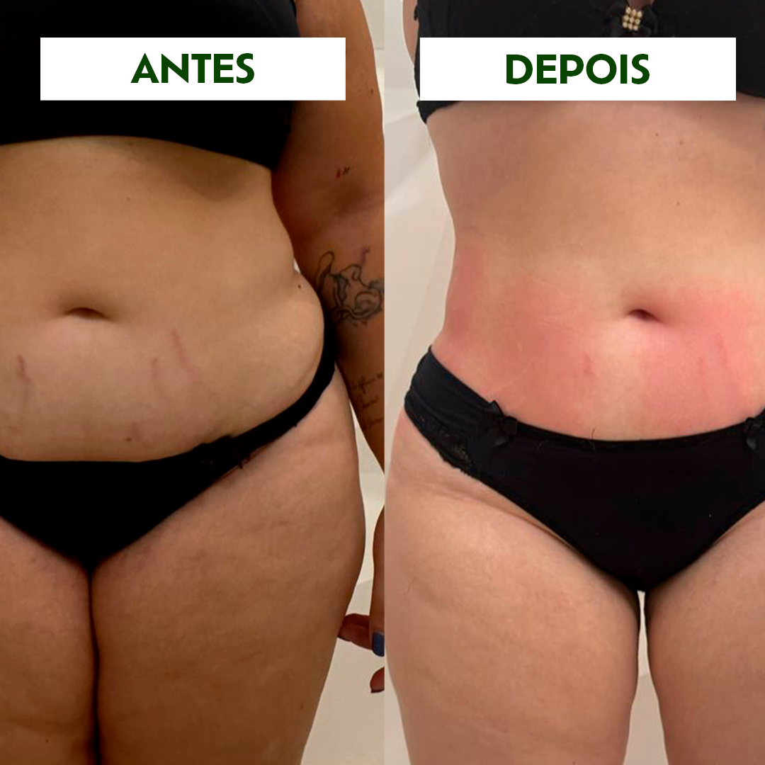 CREME REDUTOR DE MEDIDAS FIT UP
